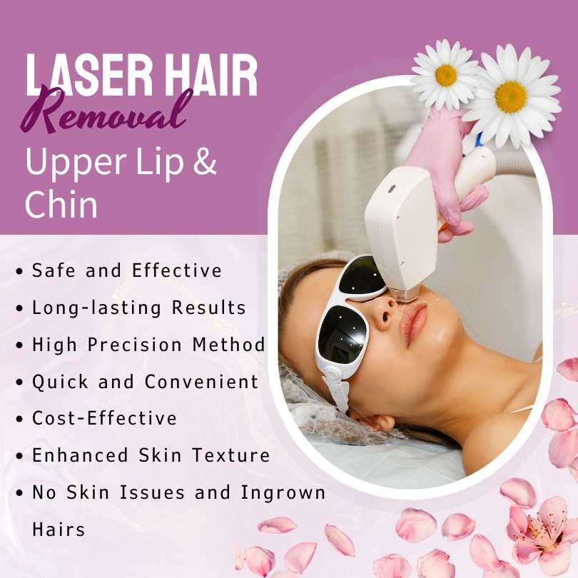 Laser Hair Removal Upper Lip Chin