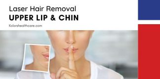 Laser Hair Removal Upper Lip Chin