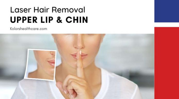 Laser Hair Removal Upper Lip Chin