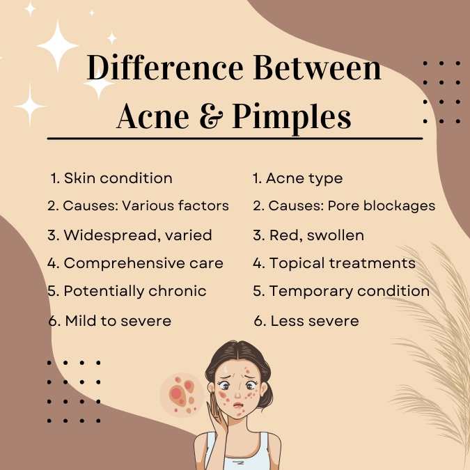 Difference between Acne and Pimples