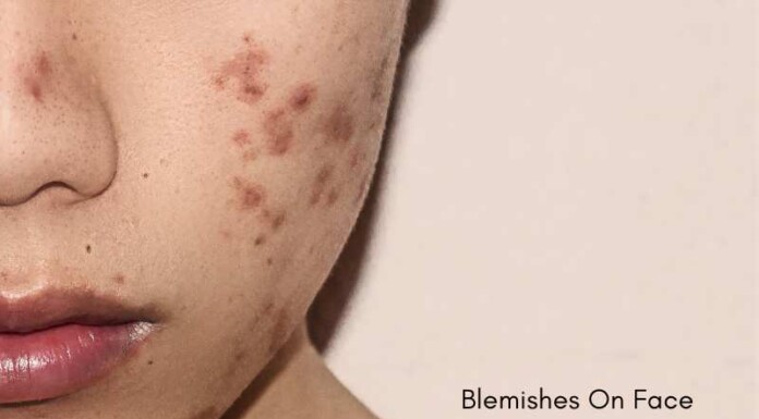 Blemishes On Face