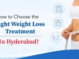 How to Choose the Right Weight Loss Treatment in Hyderabad? How to Choose the Right Weight Loss Treatment in Hyderabad?