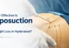 How Effective Is Liposuction for Weight Loss in Hyderabad? How Effective Is Liposuction for Weight Loss in Hyderabad?