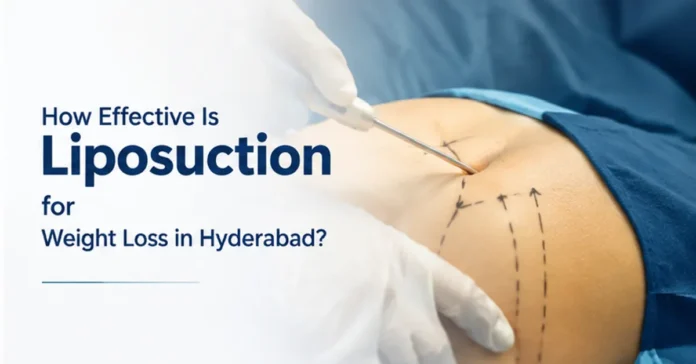 how-effective-is-liposuction-for-weight-loss-in-hyderabad How Effective Is Liposuction for Weight Loss in Hyderabad?