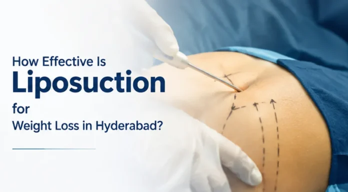 How Effective Is Liposuction for Weight Loss in Hyderabad? How Effective Is Liposuction for Weight Loss in Hyderabad?